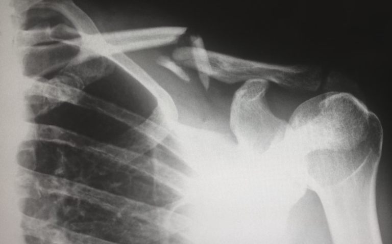 Types of Lawyers You Need After Sustaining a Personal Injury